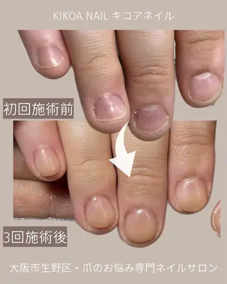 ネイル KIKOA NAIL キコアネイルのネイルデザイン