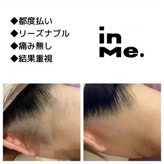 メンズ キッズ ◆つど払い脱毛◆ in Me.インミーのエステ・リラクイメージ