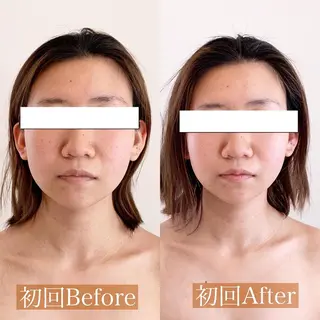小顔＆美肌 Re :setのエステ・リラクイメージ