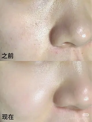 ネイル 愛維美水光専門店 川崎彩鳳のエステ・リラクイメージ