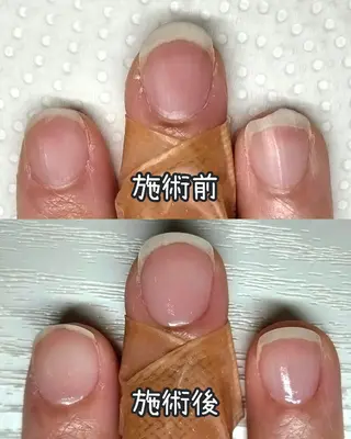 ネイル 【まみ】 Ka Pilinaのネイルデザイン