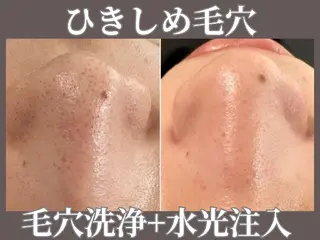 MavY.西葛西店 エステサロンのエステ・リラクイメージ