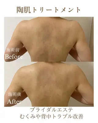 肌質改善専門サロン Lusisのエステ・リラクイメージ