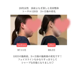 よもぎ蒸し・腸もみ 石川理沙のエステ・リラクイメージ