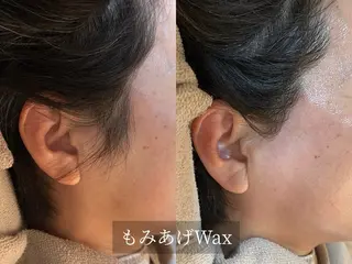 脱毛サロン Arumのエステ・リラクイメージ