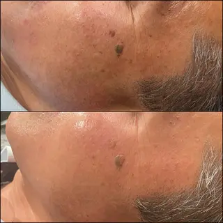 LiZA エステティックサロンのエステ・リラクイメージ
