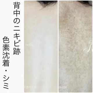 ハーブピーリング専門 BIOPLUS+川崎のエステ・リラクイメージ