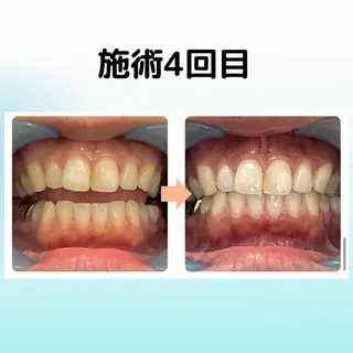 ホワイトニング シャトンのその他イメージ