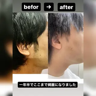 メンズ メンズ脱毛サロン ／金山昌弘のエステ・リラクイメージ