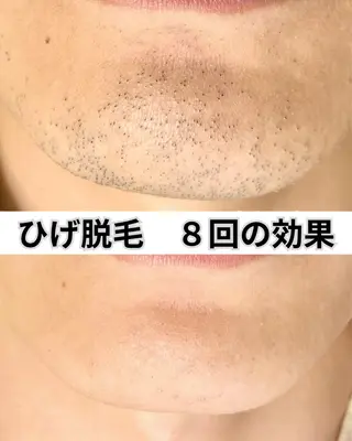 脱毛サロン FIS武蔵小杉店のエステ・リラクイメージ