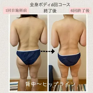 メンテナンスエステ Lampeのエステ・リラクイメージ