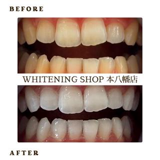 メンズ ホワイトニング ショップ本八幡店のエステ・リラクイメージ