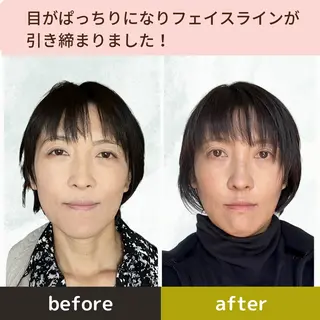 小顔&ヘッドスパ/ もりもとまきみのエステ・リラクイメージ