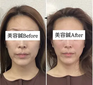 美容鍼灸×小顔整体♡ ハリサロンドオフ堺東のその他イメージ