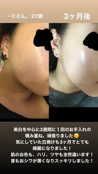Natsu *メンズネイリストのネイルデザイン