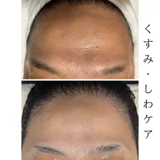 肌管理エステサロン｜ Connect ゆいのエステ・リラクイメージ