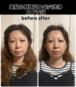 小顔矯正＆毛穴洗浄 空ルートfavoriのエステ・リラクイメージ