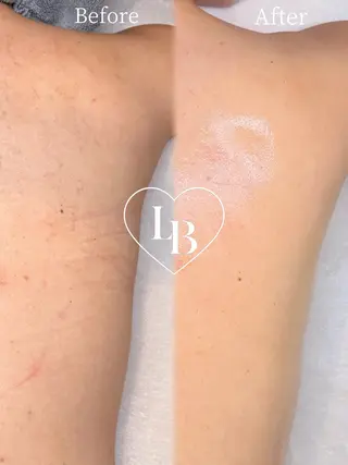 Lattina ラティーナのエステ・リラクイメージ