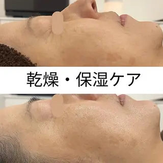 ハーブピーリング LINON(リノン)のエステ・リラクイメージ
