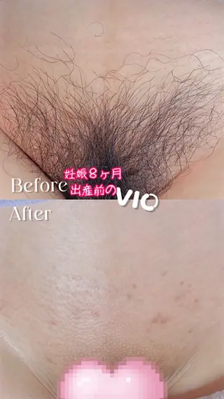 豊橋 |Hitomi シュガーリング専門店のその他イメージ