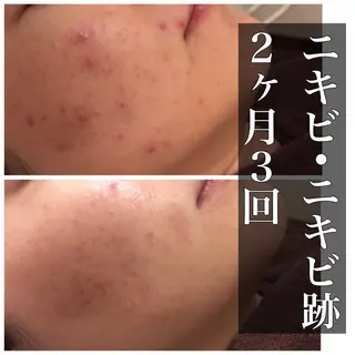 ミディアム カラー パーマ ヘアアレンジ メンズ キッズ ネイル マツエク・マツパ ニキビ・肌質改善専門 ♡人生が変わるサロンのエステ・リラクイメージ