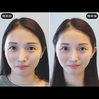 渋谷 小顔美容鍼 専門サロン YZのエステ・リラクイメージ