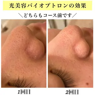Bellesthe (ベルエステ)のエステ・リラクイメージ