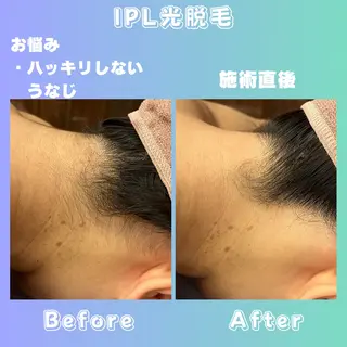 肌質改善/都度脱毛 Mahinaのエステ・リラクイメージ
