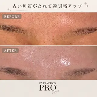 毛穴ケア✖️まつげ Feliceのエステ・リラクイメージ