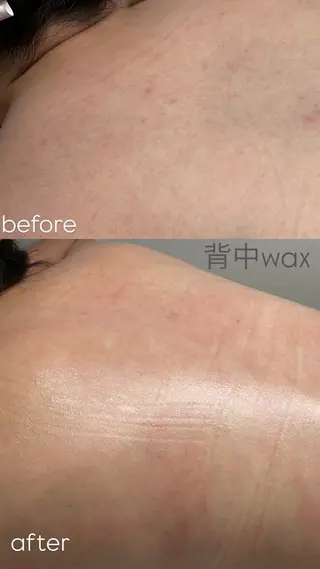 なみ|WAX脱毛専門 店|さいたま市のエステ・リラクイメージ