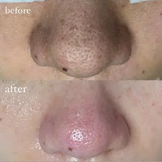 beauty salonWのエステ・リラクイメージ