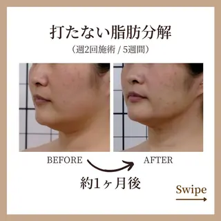 コガオファクトリー 北24条店のエステ・リラクイメージ