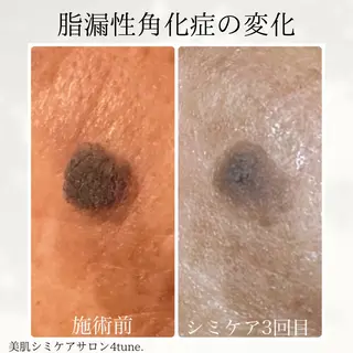 美肌シミケアサロン 4tune.RUMIのその他イメージ