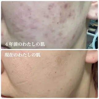 吉村 琴乃のエステ・リラクイメージ