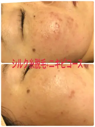 ❤️予約殺到❤️mi オールハンド痩身専門のエステ・リラクイメージ
