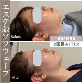 小顔矯正・美肌ケア 池田 桃花のエステ・リラクイメージ
