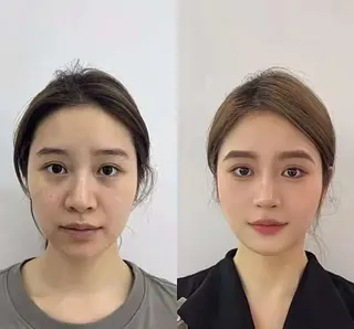 ネイル 愛維美水光専門店 川崎彩鳳のエステ・リラクイメージ