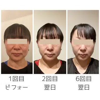 晴れ晴れ 整体院のエステ・リラクイメージ