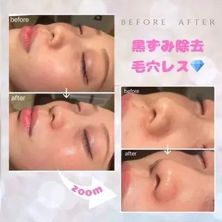 表参道/痩身/ リンパ長谷川のエステ・リラクイメージ