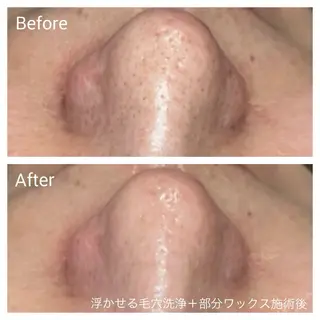 深い肌悩み&早期脱毛 完了サロンのエステ・リラクイメージ