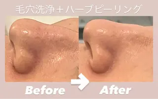 韓国肌管理 Belle堀江のエステ・リラクイメージ