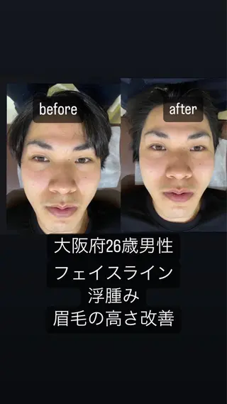めばえ整骨院 城戸のエステ・リラクイメージ
