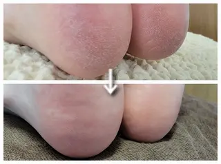 ネイル&巻き爪サロン AKnailのネイルデザイン