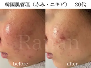 韓国肌管理/眉毛専門 Ranan(ラナン)の眉毛・アイブロウイメージ