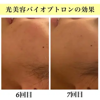 Bellesthe (ベルエステ)のエステ・リラクイメージ