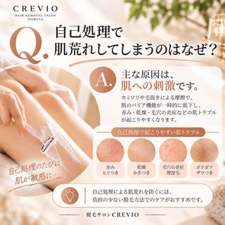 脱毛サロン CREVIOのエステ・リラクイメージ