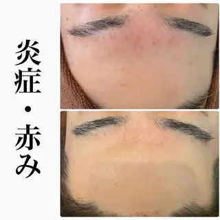 ハーブピーリング専門 BIOPLUS+川崎のエステ・リラクイメージ