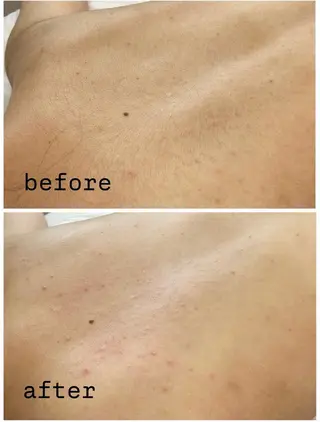 シュガーリングサロン Lumunaのエステ・リラクイメージ