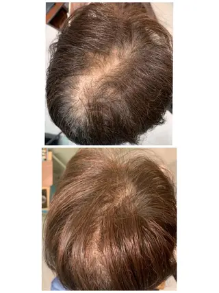 ショート ヘアアレンジ Kanal Kanaのエステ・リラクイメージ