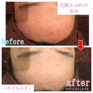 ミディアム カラー パーマ ヘアアレンジ メンズ キッズ ネイル マツエク・マツパ 金の糸脱毛 産毛ケア専門のエステ・リラクイメージ